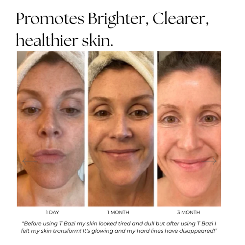 A before-and-after skincare comparison graphic showing three vertical panels of a woman's face over 1 day, 1 month, and 3 months of use. The top text reads 'Promotes Brighter, Clearer, healthier skin.